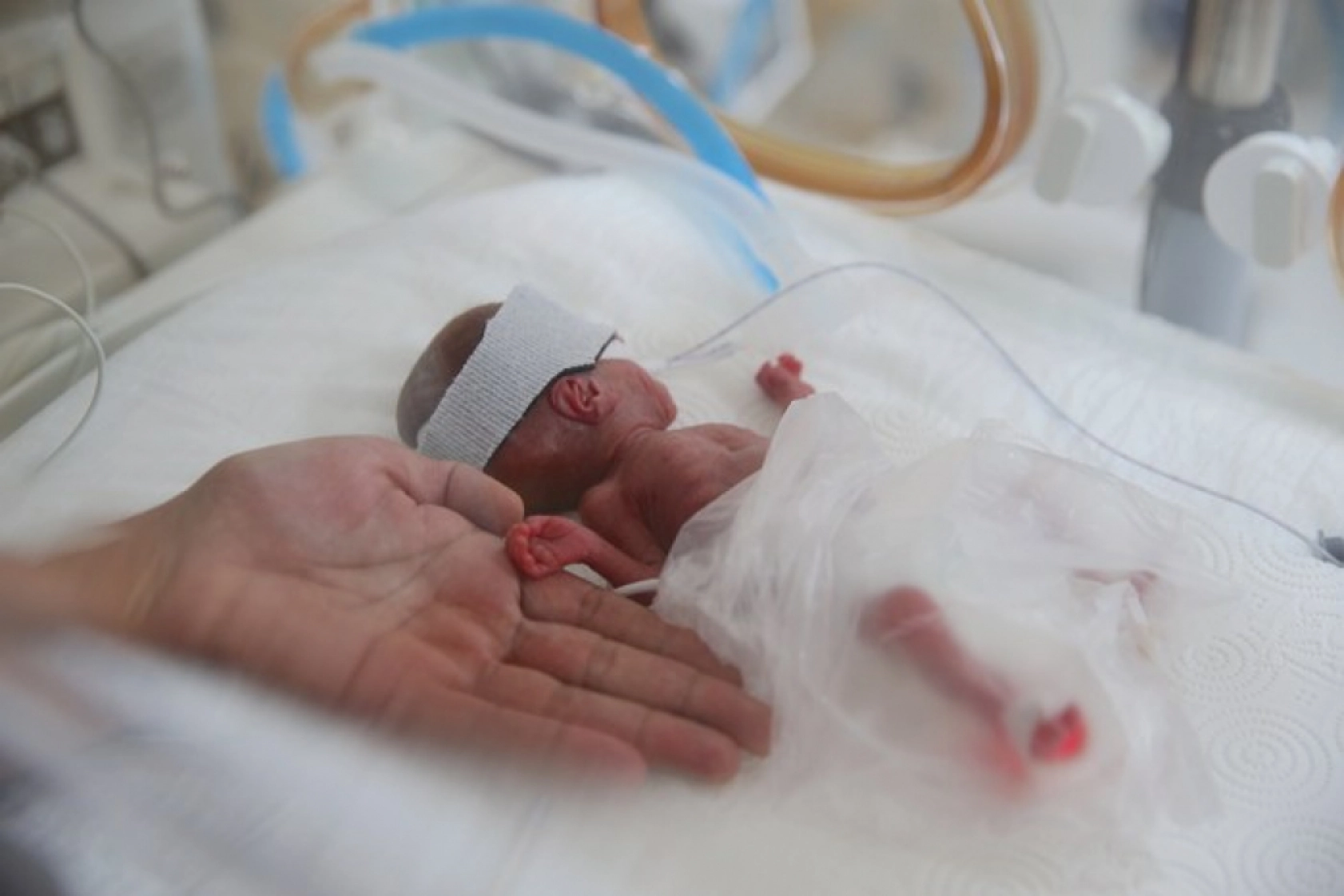 Van'da 'Parmak Bebekler' Hayata Tutunuyor