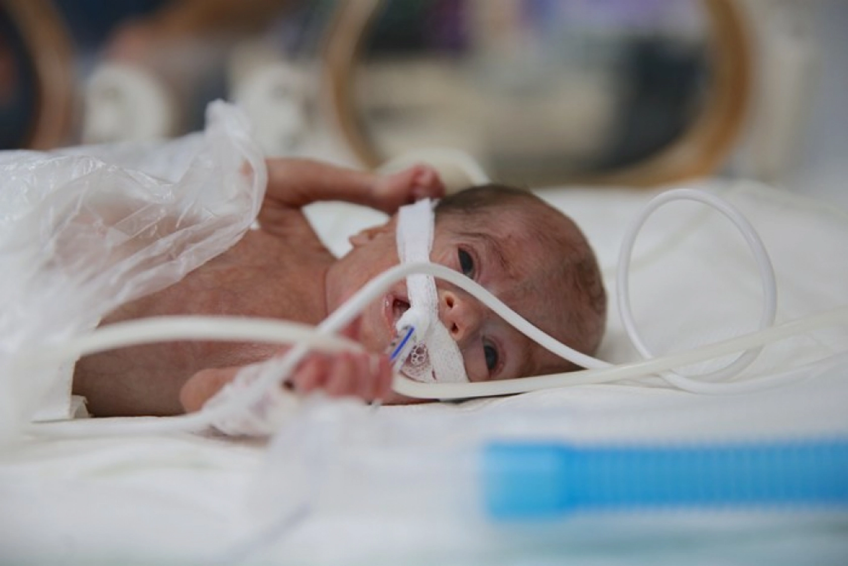 Van'da 'Parmak Bebekler' Hayata Tutunuyor