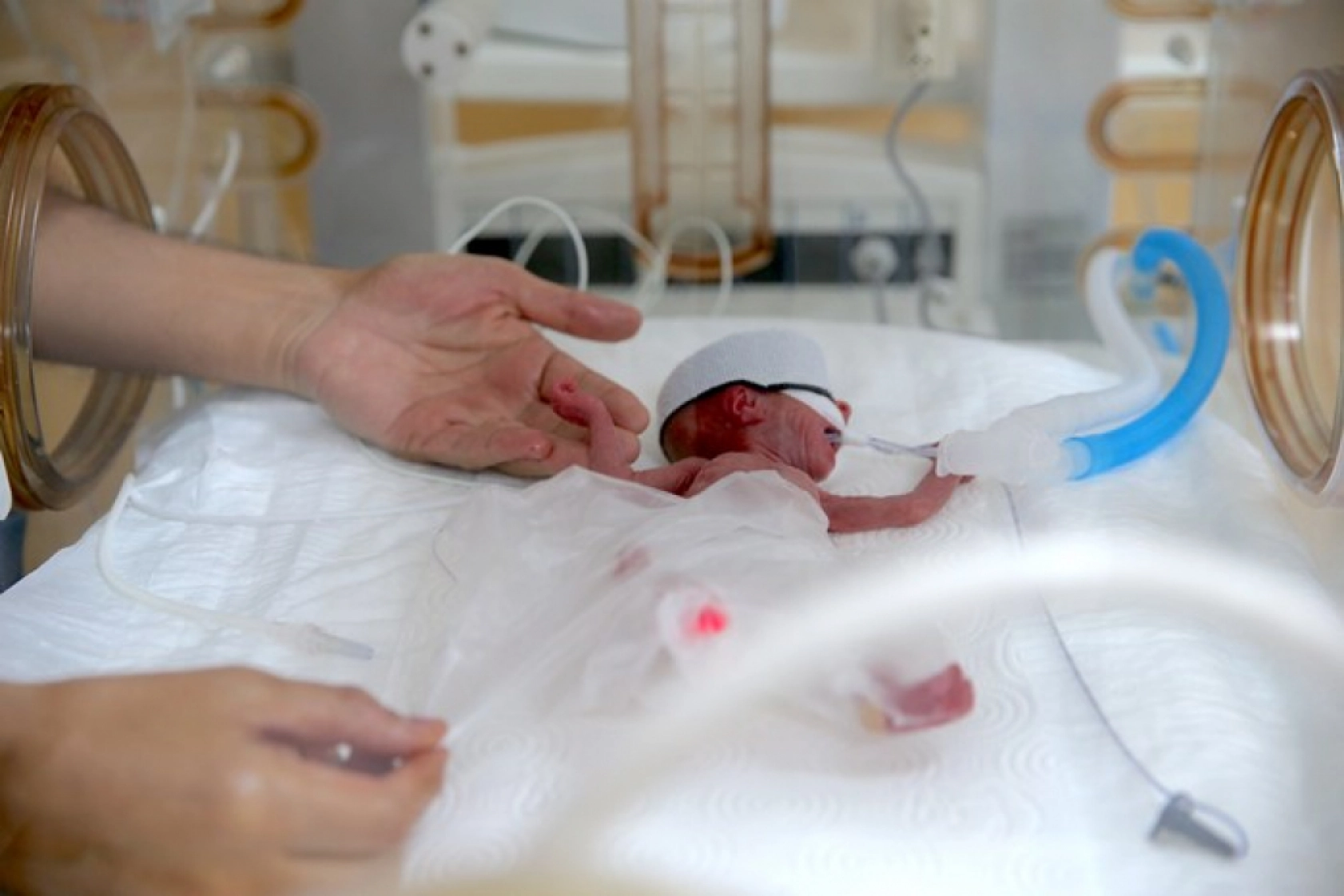 Van'da 'Parmak Bebekler' Hayata Tutunuyor