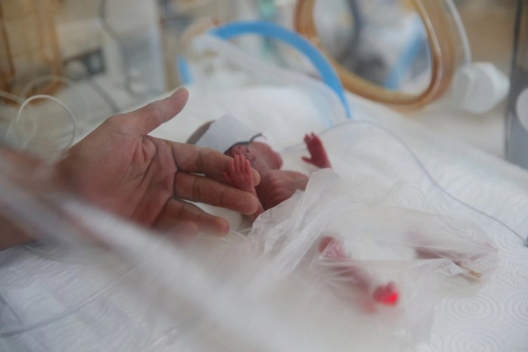 Van'da 'Parmak Bebekler' Hayata Tutunuyor