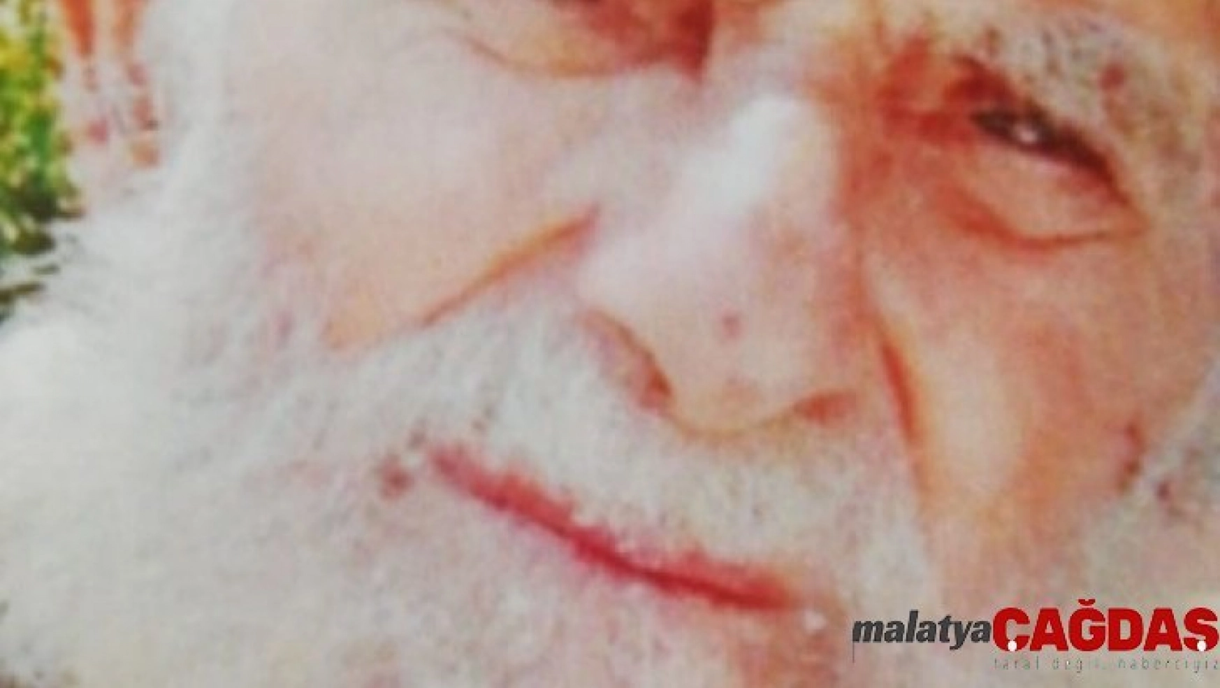 Kayıp Alzheimer hastası yaşlı adam aranıyor