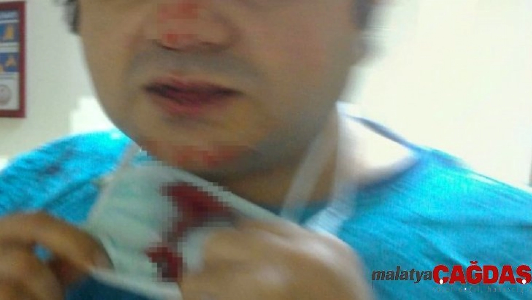 Osmaniye'de doktoru darp edip burnunu kıran saldırgan tutuklandı