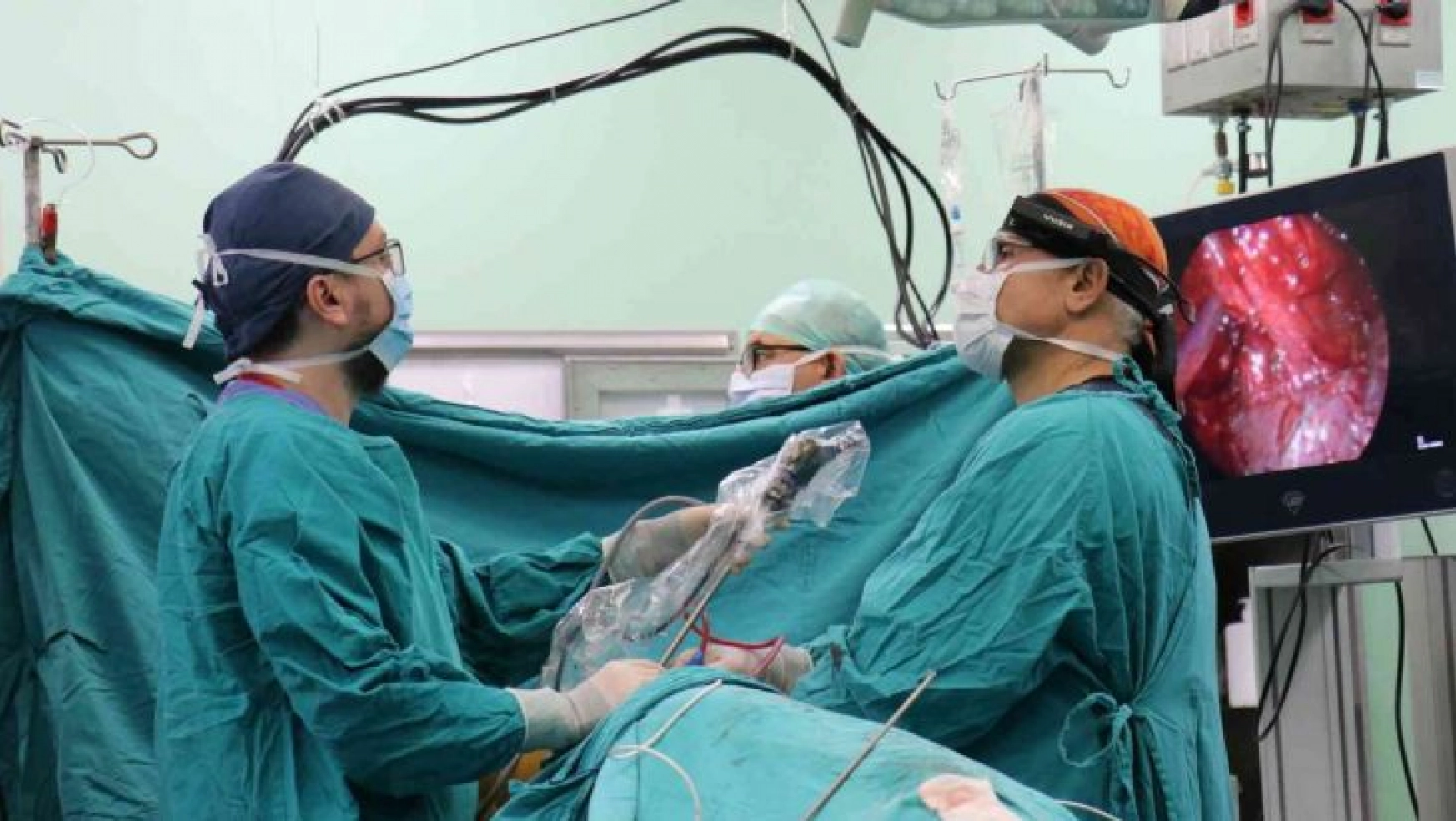 TÖTM'de çevrimiçi Torasik Cerrahi Akciğer ameliyatı