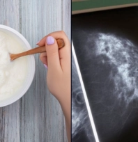 Yoğurt tüketimi meme kanserine karşı koruyucu olabilir mi?