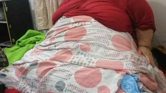 300 kiloya ulaşan genç kadının tek isteği sağlığına kavuşmak