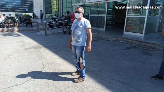 Acemi kasaplar hastanelik oldu