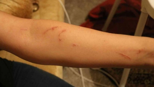 Diyarbakır'da iddiaya göre kiracı kadın ve engelli çocuğu ev sahibinin ailesi tarafından darp edildi