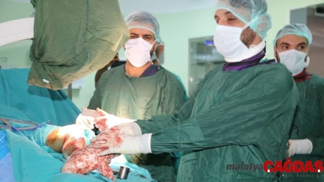Diyarbakır'da manyetik çivi ile bacak uzatma ameliyatı gerçekleştirildi