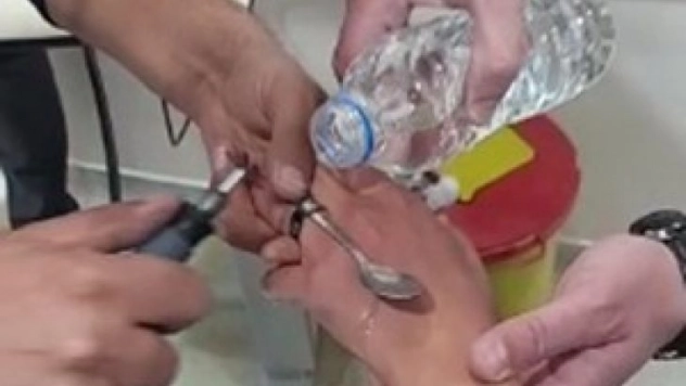 Elazığ'da İtfaiyeden Yüzük Çıkarma Operasyonu