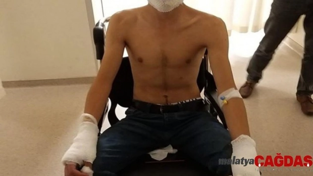 Evi yakmak isterken kendini ve arkadaşlarını yaktı