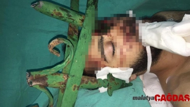 Gencin yüzüne saplanan çubuk için hastanedeki operasyona itfaiye ekibi de dahil oldu