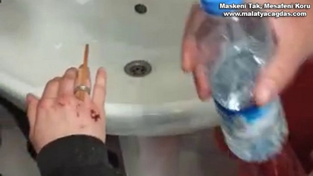 İtfaiyeden yüzük operasyonu