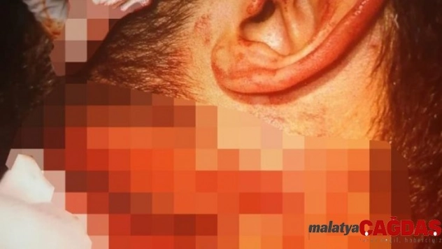 İzmir'de doktora jiletli saldırıyı yapan zanlı: 'Dövmeye gittim'