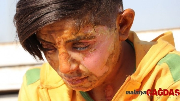 Kendisini ihbar eden genç kızı üzerine benzin döküp yakan cani yakalandı