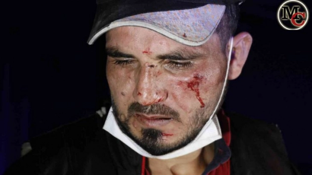 Köpek havlayınca vatandaşlar hırsızı yakaladı, ardından öldüresiye darp etti