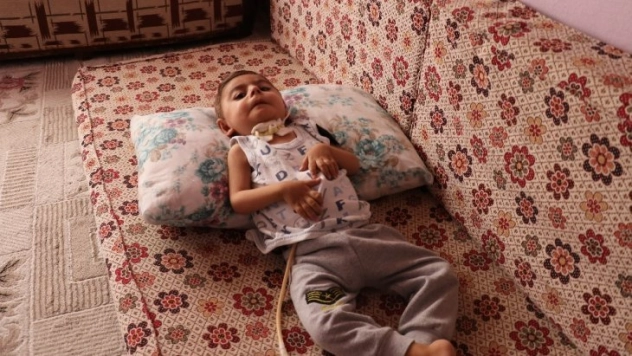 Küçücük bedeni ile yaşam savaşı veriyor