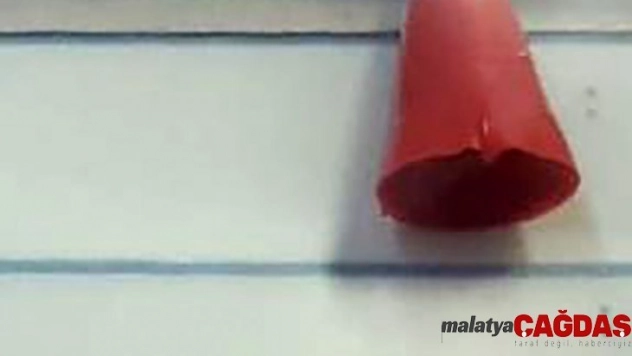 Mert'in ölümüne neden olan o parça otopsiyle çıkarıldı