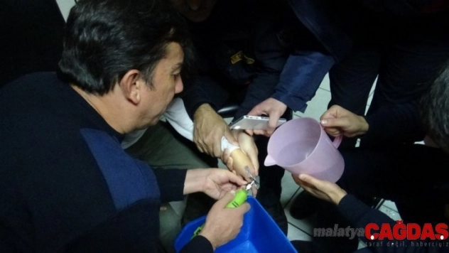 Parmağı kapı topuzuna sıkıştı, yardımına itfaiye ekipleri yetişti