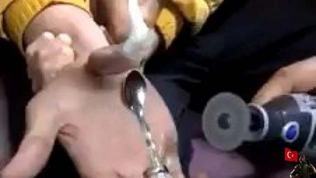 Parmağın sıkıştığı yüzüğü itfaiye çıkarttı