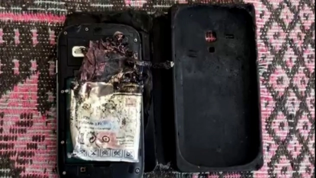 Patlayan cep telefonu bacağını parçaladı