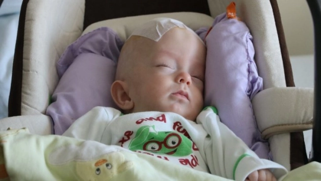 Prematüre bebeğe beyin ameliyatı