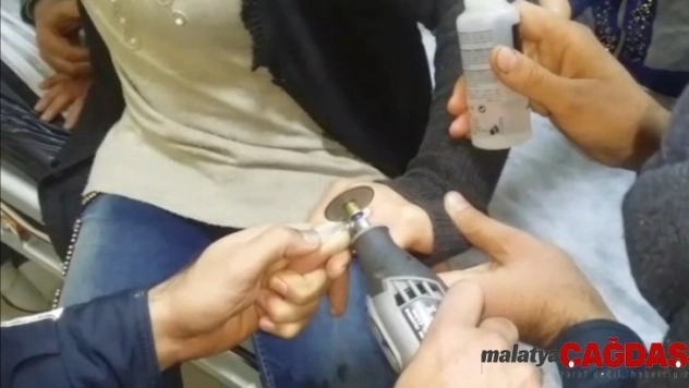 Şanlıurfa'da genç kadının parmağına sıkışan yüzük kesilerek çıkarıldı