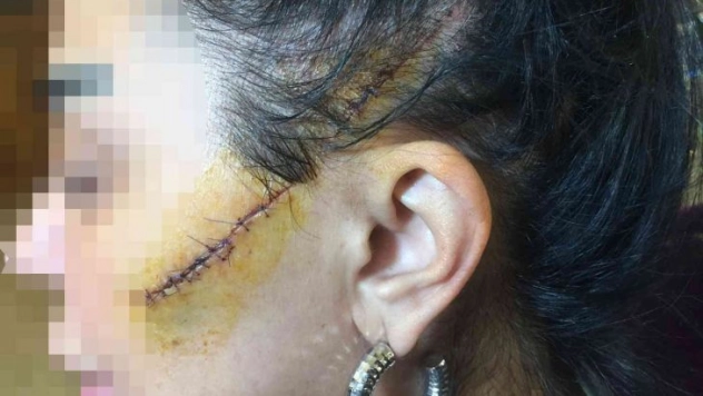 Saplantılı aşık dehşeti