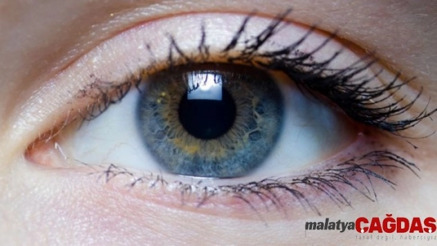 Sarı nokta hastalığı, aferez yöntemi ile durdurulabiliyor