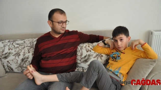 Vücudunda yanık oluşan öğrencinin babası konuştu