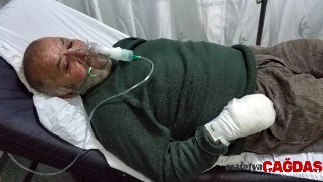 Yangında hayvanları kurtarmak isterken hastanelik oldu