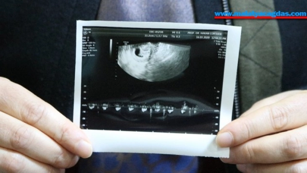 Yıllar süren çocuk hasreti akupunktur ve PRP tedavisiyle son buldu