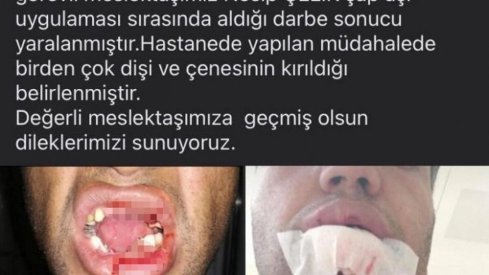 Huysuz inek veterinerin çenesini kırdı