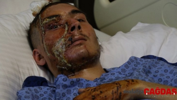 Bu halde hastaneden taburcu edildi, ailesi gözyaşına boğuldu