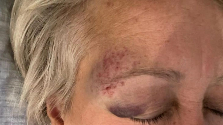 Göbeklitepe'de kazı başkanlığı yapan Alman arkeoloğun eşinden darp iddiası