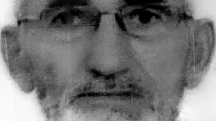 İncir ağacından düşen yaşlı adam hayatını kaybetti