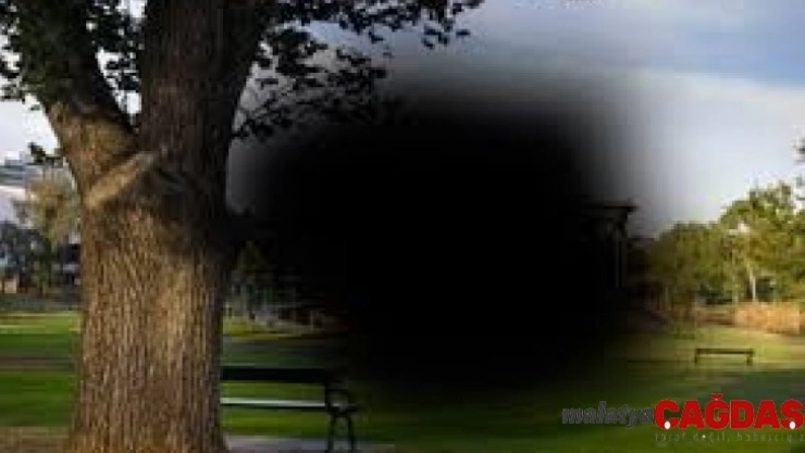 Sarı nokta hastalığı erken evrede tedavi edilebiliyor