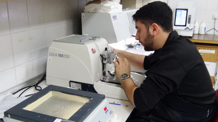 Patolojiye Gönderilen Her Örnek Kanser Değildir