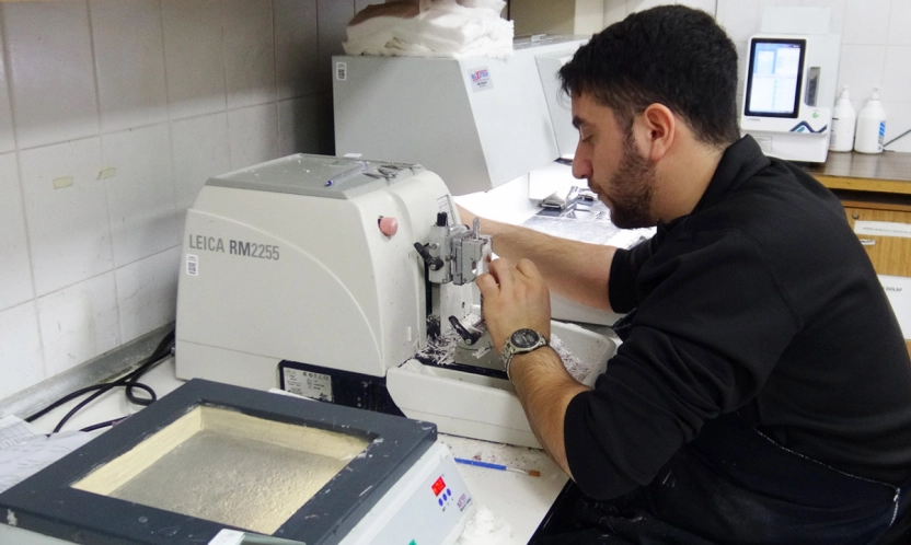 Patolojiye Gönderilen Her Örnek Kanser Değildir